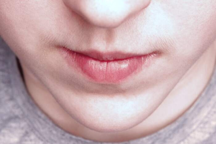 موهای زائد پشت لب