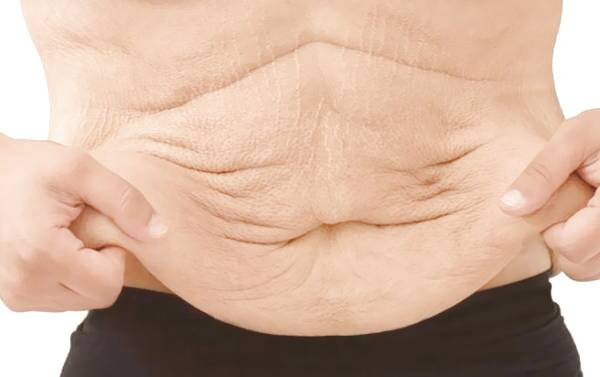 شل شدن پوست