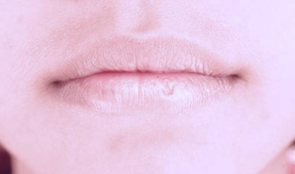 علت خشکی لب ها