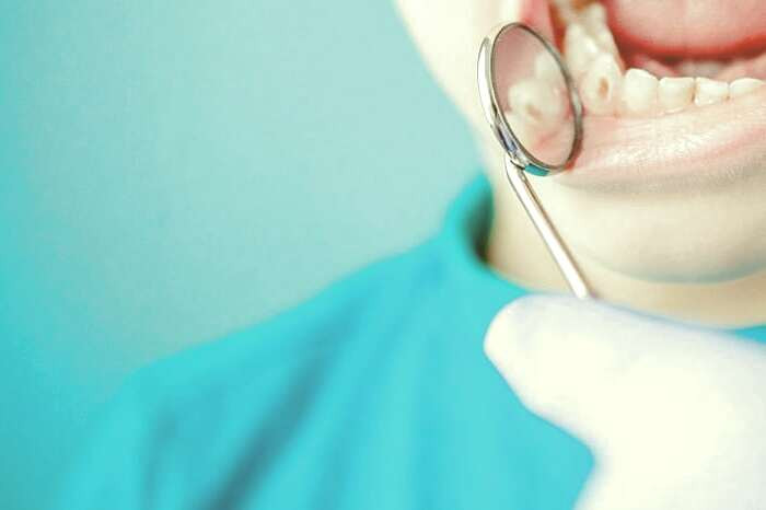 پوسیدگی دندانها