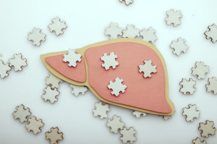 عمل پیوند کبد