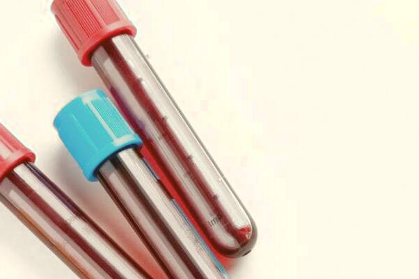 تست آزمایشگاهی