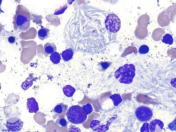 علت بیماری گوشه