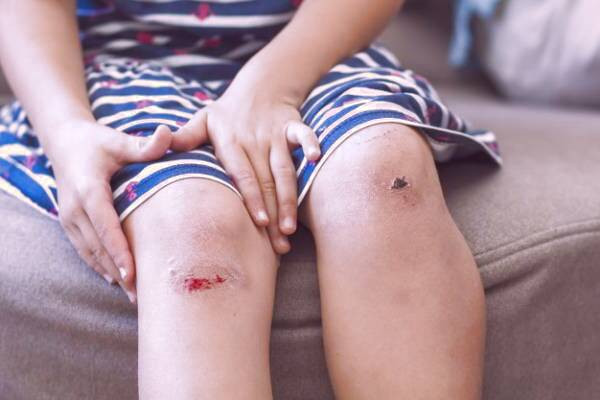 روش مراقبت از زخم باز