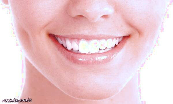 پروتز دندان 