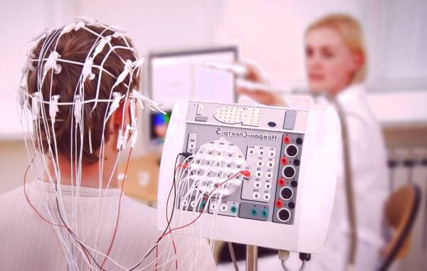الکتروانسفالوگرام (EEG)