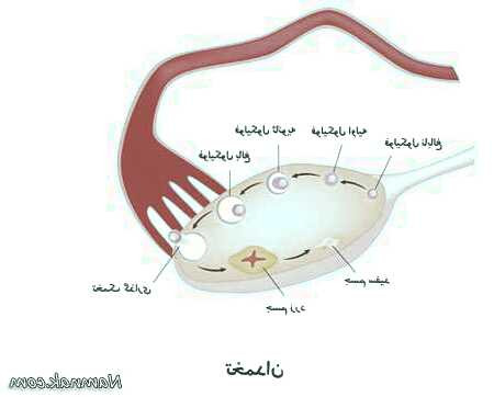 بیماری پیچ خوردگی تخمدان