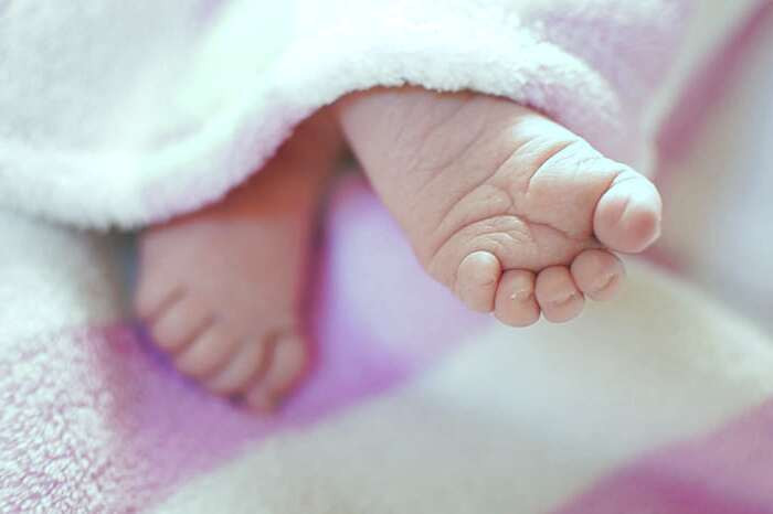 کج شدن پای نوزاد