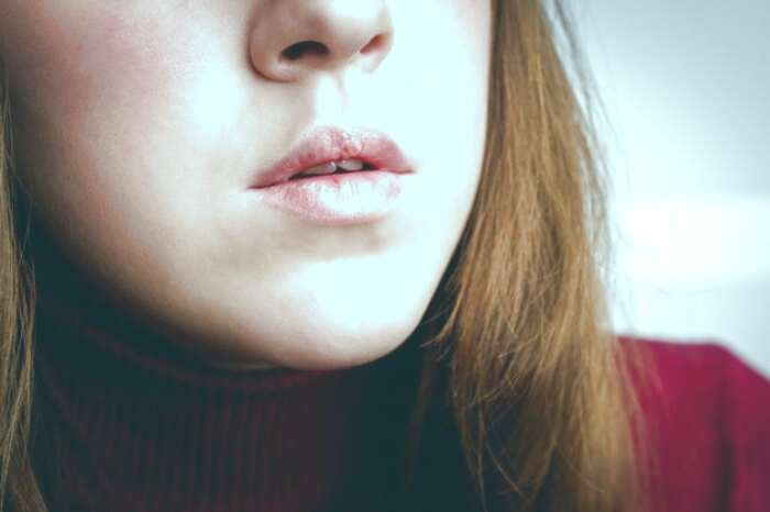 ترک گوشه های لب
