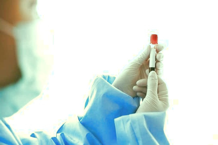 آلدوسترون خون و نارسایی اولیه غدد فوق کلیوی آلدوسترون خون