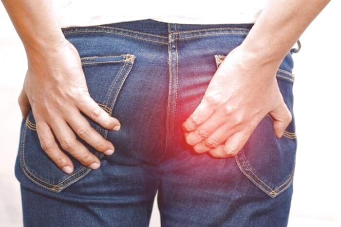 راه پیشگیری از هموروئید پیشگیری از هموروئید