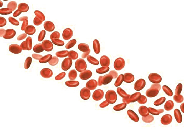 کم خونی و خستگی مفرط کم خونی