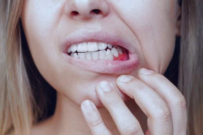مشکلات لثه از علائم مشکلات استخوانی مشکلات لثه ها