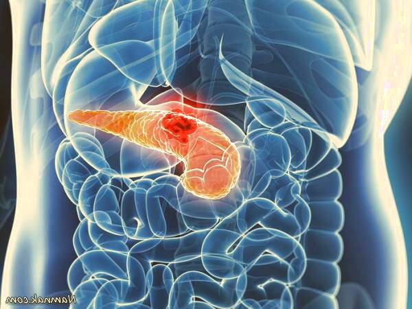  سم زدایی پانکراس 