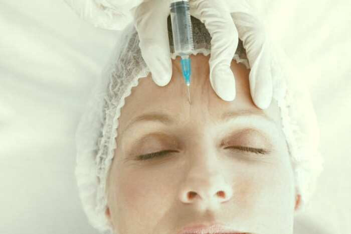 بوتاکس پیشانی