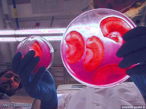 کاشت گوش انسان با سلولهای سیب