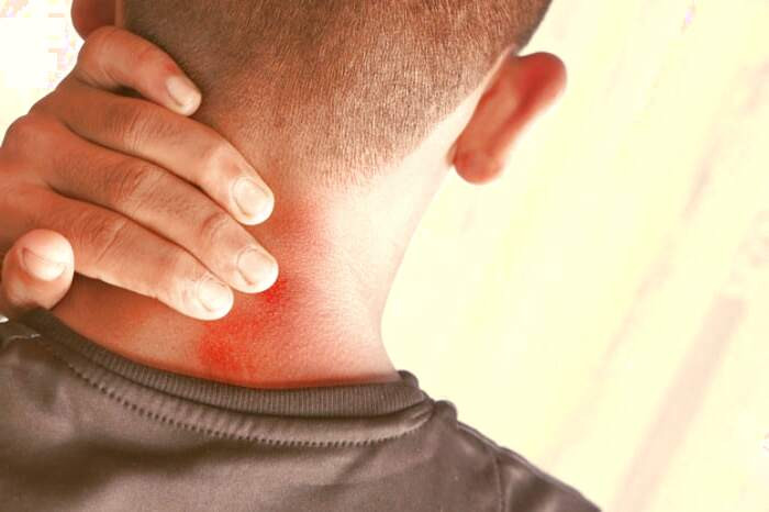 انتقال درد از گردن به سر