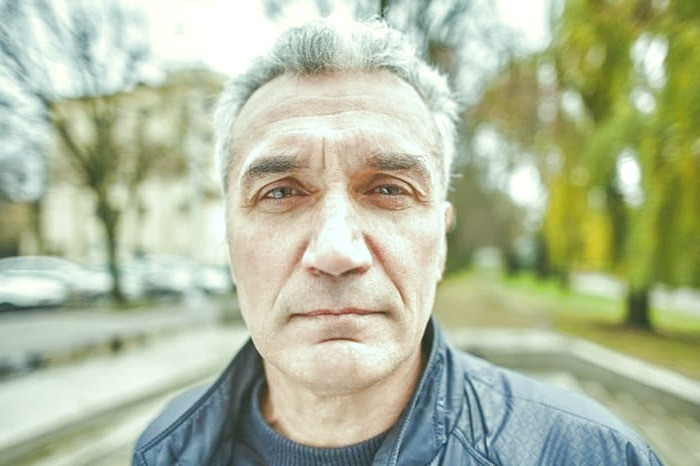 سفید شدن مو