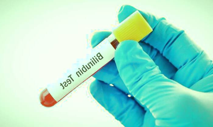 افزایش بیلی روبین خون