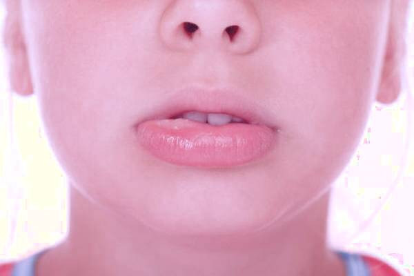 علائئم ورم لب