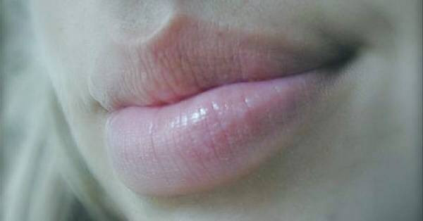 تورم لب و حساسیت