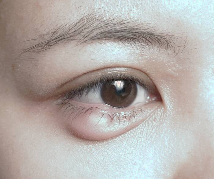 داکریوسیتیت