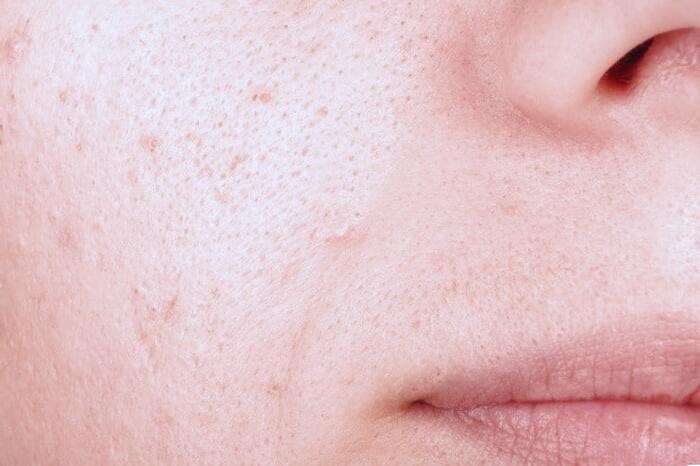 منافذ باز صورت