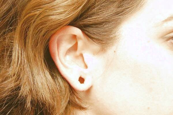 علت بوی بد پشت گوش