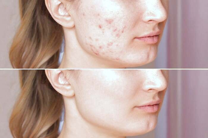 سیب زمینی برای جوش 