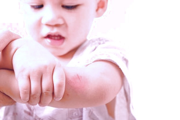 درمان زخم سطحی