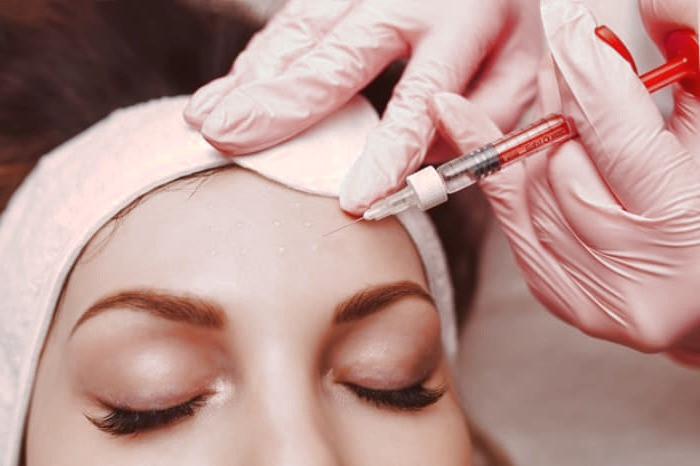 مزوتراپی صورت