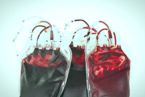 کیسه های خون