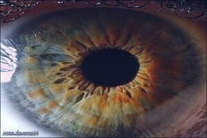 کاشت تلسکوپ در چشم