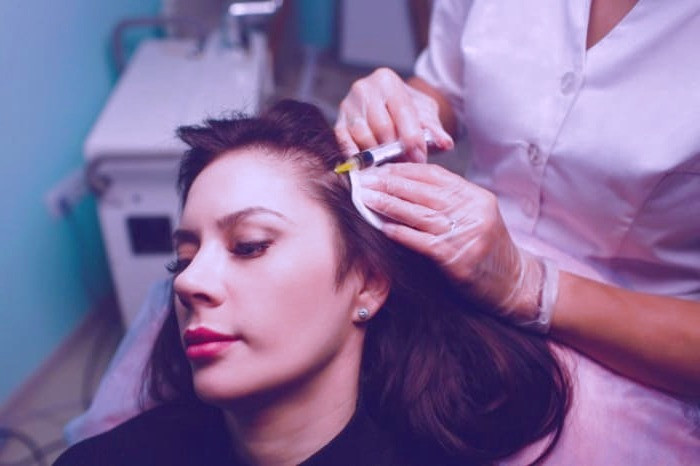 مزوتراپی مو