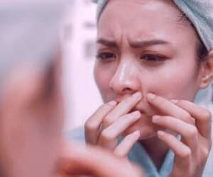 بهترین راهکار برای تخلیه جوش های صورت | نکات مهم