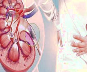 دلایل ، علائم ، روش های تشخیص و درمان سنگ های کلیوی
