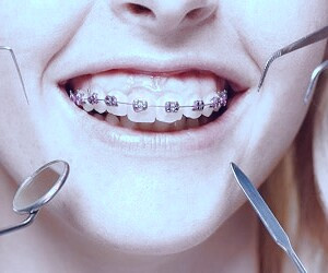 بهترین متخصصان ارتودنسی: 5 نکته برای انتخاب درست