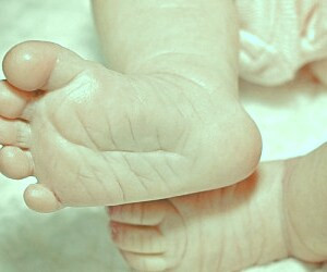بررسی علل و راه های درمان انحراف پاها در کودکان