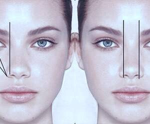 بررسی انواع جراحی های بینی شامل گوشتی و استخوانی