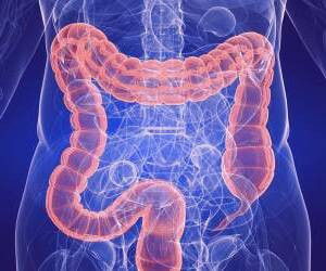 بهترین راهکارها برای پیشگیری از سرطان روده بزرگ