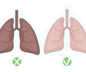 تشخیص سرطان ریه با روش نوین