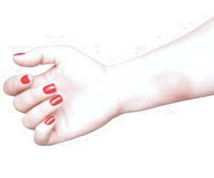 بازیابی سوختگی با درمان های طبیعی