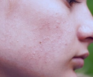 پوست جوان: راهنمای ساخت ماسک های خانگی موثر