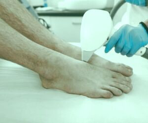 لیزر موهای زائد در یک جلسه: امکان پذیر است