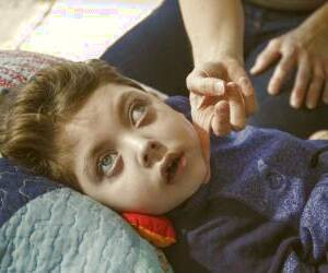 بررسی جامع بیماری کرابه: از علل تا درمان