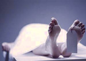 بررسی تغییرات بدنی پس از مرگ