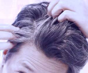 درمان زودرس سفیدی مو با این روش قطعی است