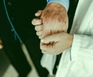 علائم آلزایمر و روش‌های پیشگیری و درمان آن