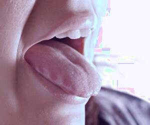 5 نشانه سرطان زبان که باید بدانید