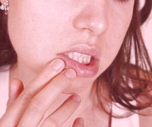 دلایل ورم لب و درمان آن با عسل به همراه 15 روش سریع دیگر